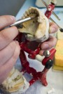 Zahnersatz, Implantatprothetik, Keilwerth